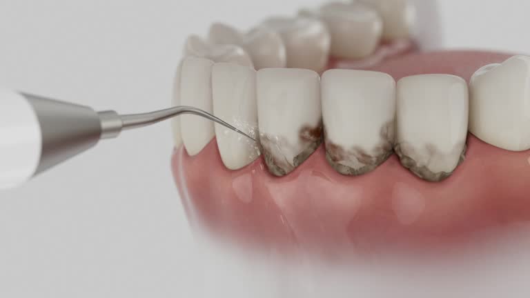 Reliable Tooth Extraction contractor in Davidson County County, TN by Dentist Open Now